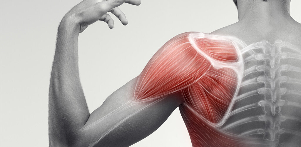 Grafik von Muskelsträngen einer Schulter 